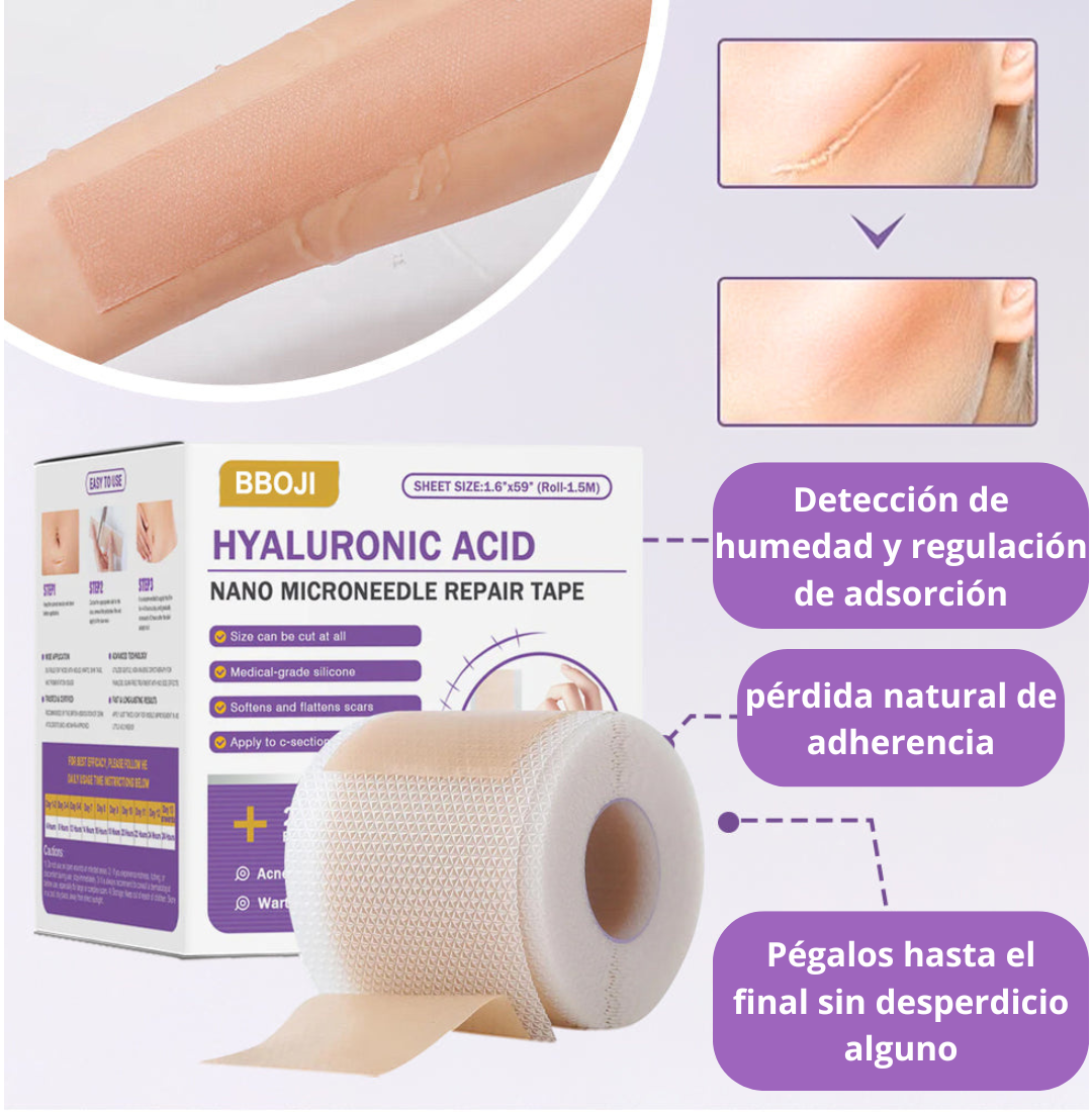 Tienda Oficial | Cinta Reparadora Nano Hialurónica® – Tratamiento Avanzado y Comprobado para Cicatrices, Estrías y Marcas