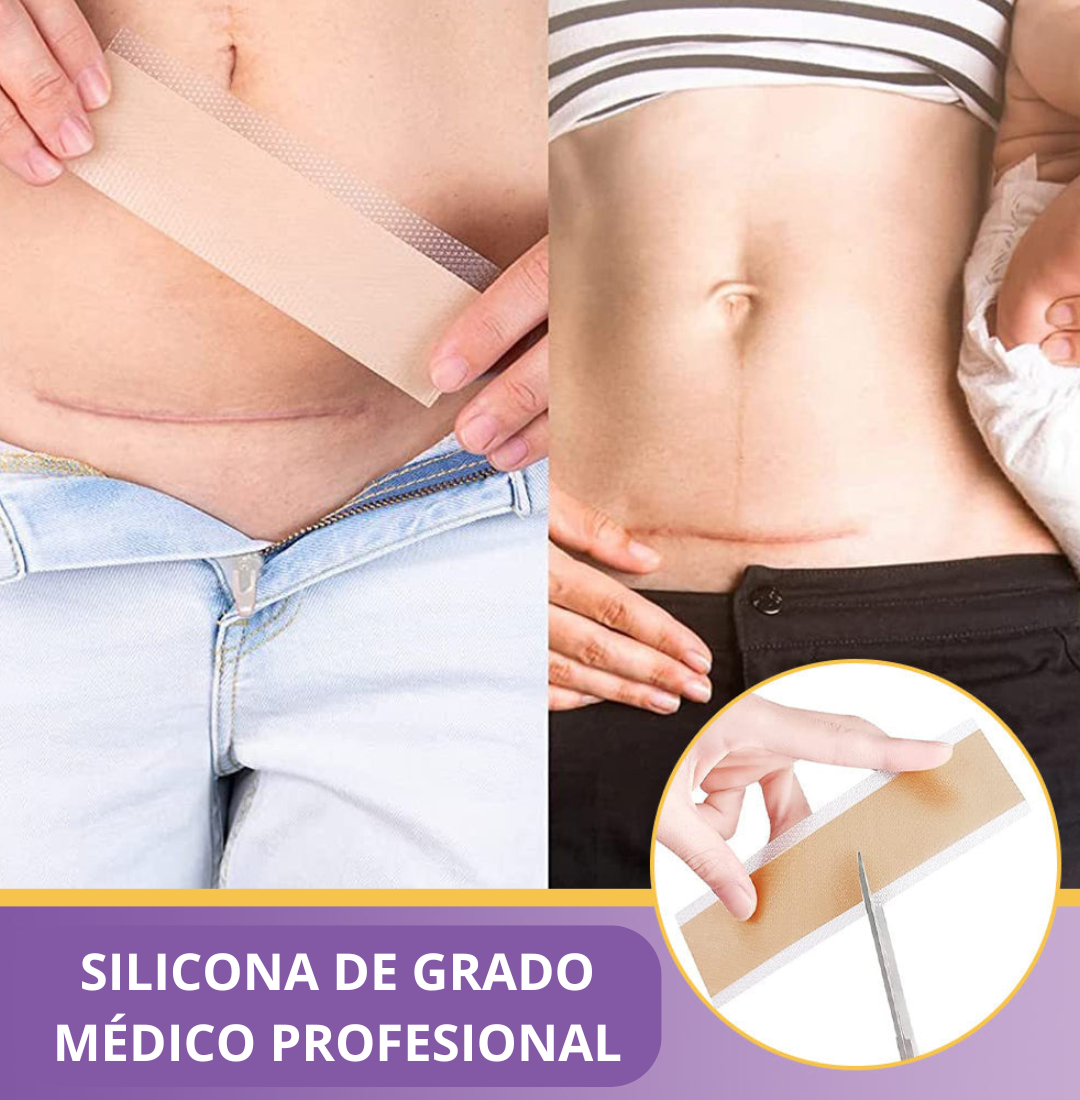 Tienda Oficial | Cinta Reparadora Nano Hialurónica® – Tratamiento Avanzado y Comprobado para Cicatrices, Estrías y Marcas