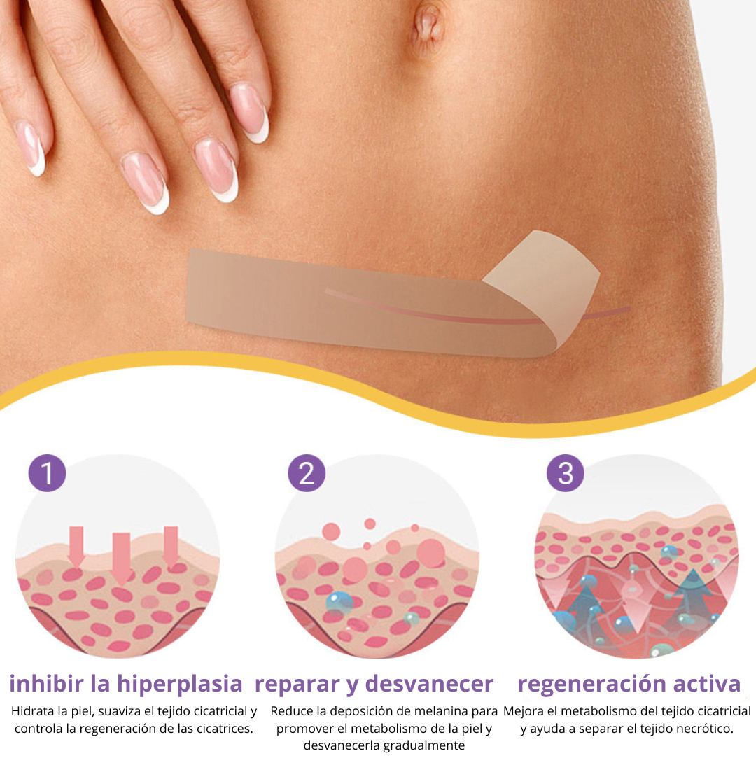 Tienda Oficial | Cinta Reparadora Nano Hialurónica® – Tratamiento Avanzado y Comprobado para Cicatrices, Estrías y Marcas